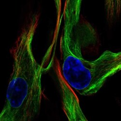 Vimentin Antibody, Novus Biologicals:Antibodies:Primary Antibodies